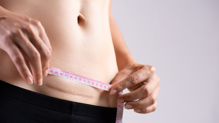 Have Anxiety About a Scheduled C-Section? Here are 7 Ways to Beat It