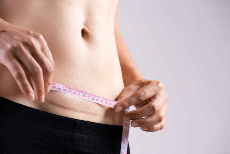 woman measuring c section scar