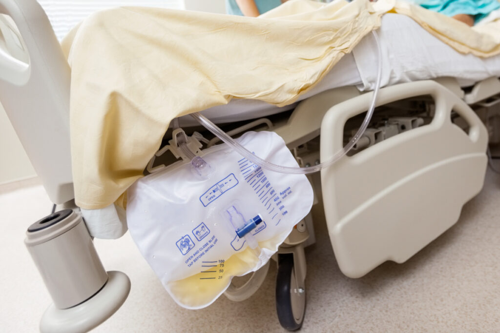 catheter bag attached to postpartum patient's bed at hospital with nurse attending